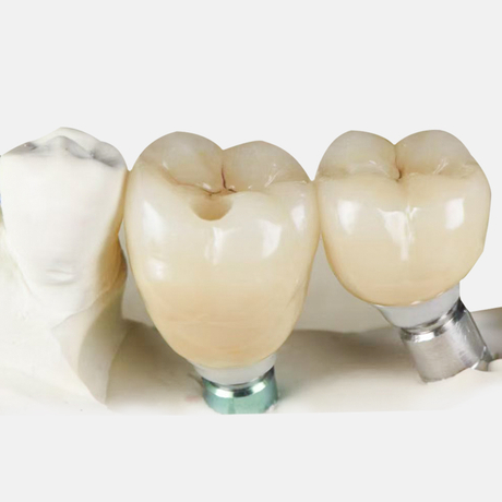 Implanting-Crown.jpg